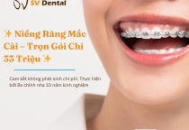 CHỊ PHÍ NIỀNG RĂNG MỚI NHẤT TRỌN GÓI CHỈ 33 TRIỆU 