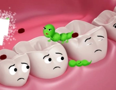 Sâu răng – Sát thủ âm thầm nhưng thật đáng sợ