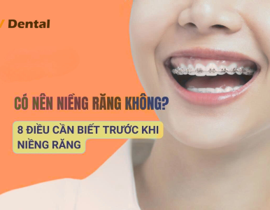 Có nên niềng răng không? 8 điều cần biết trước khi quyết định niềng răng. Nha khoa SV 