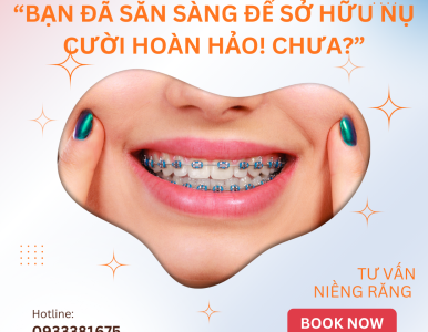 Niêng răng mắc cài trọn gói 33 triêu- gồm những gì ? 