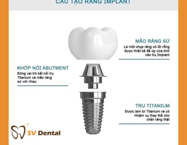 Cấy ghép Implant có đau không?