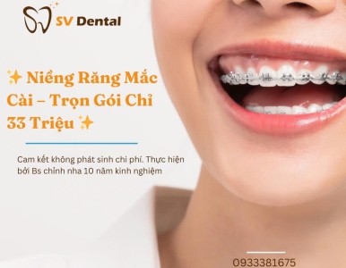 CHỊ PHÍ NIỀNG RĂNG MỚI NHẤT TRỌN GÓI CHỈ 33 TRIỆU 