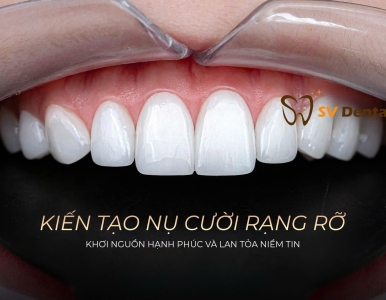 Mặt dán sứ có bền không ? sự thật  và lời khuyên từ chuyên gia NHA KHOA SV , Phường Bàn Cờ 