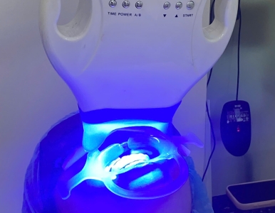 Tại sao men răng ố vàng, nguyên nhân và cách khắc phục  và giải pháp tẩy trắng hiệu quả tại NHA KHOA SV 