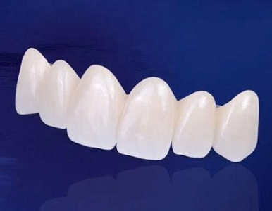 Bảng giá răng sứ Zirconia DMax/DDBIO – 5.000.000đ/răng | Nha Khoa SV