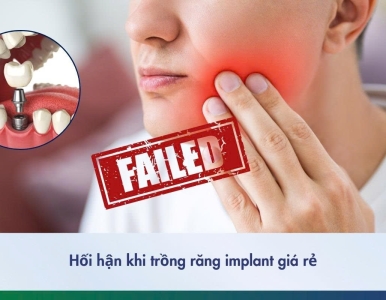 Hối hận khi trồng Implant giá rẻ: 6 rủi ro nguy hiểm cần biết