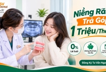 Niềng Răng Trả Góp 1 Triệu/Tháng – Không Lãi Suất, Chủ Động Chi Phí Cùng Nha Khoa SV