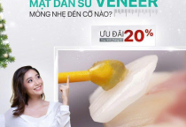 Mặt Dán Sứ Veneer Mỏng Nhẹ Đến Cỡ Nào? Giải Pháp Thẩm Mỹ Ít Mài Răng Tại Nha Khoa SV