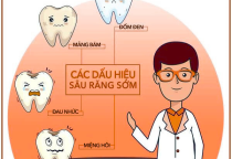 5 dấu hiệu sâu răng sớm dễ nhận biết – Đừng bỏ qua nếu muốn bảo vệ răng thật NHA KHOA SV 