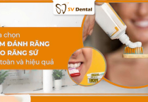 Top 6 Kem Đánh Răng Cho Răng Sứ An Toàn Và Hiệu Quả tại NHA KHOA SV 