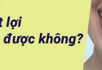 Bị tụt lợi có chữa được không? Dấu hiệu – nguyên nhân – cách điều trị hiệu quả tại Nha khoa SV