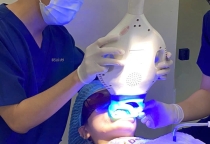Tẩy trắng răng bí quyết sở hữu nụ cười trắng sáng, không đau, không ê buốt.  Tẩy trắng răng bí quyết sở hữu nụ cười trắng sáng, không đau, không ê buốt.