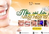 Niêng Răng Mắc Cài -Giải Pháp Hiệu Quả Tại Nha Khoa SV, Quận 3 