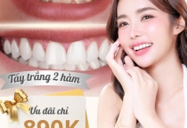 Tẩy trắng răng  890.000- Nụ cười rạng rỡ sau 60 phút Tẩy trắng răng  890.000- Nụ cười rạng rỡ sau 60 phút