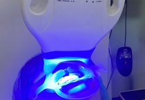 Tại sao men răng ố vàng, nguyên nhân và cách khắc phục  và giải pháp tẩy trắng hiệu quả tại NHA KHOA SV  Tại sao men răng ố vàng, nguyên nhân và cách khắc phục  và giải pháp tẩy trắng hiệu quả tại NHA KHOA SV