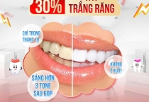 Ưu đãi  30% tẩy trắng răng tháng 10- sáng hơn 3 tone sau khi tẩy trắng răng tại NHA KHOA SV  Ưu đãi  30% tẩy trắng răng tháng 10- sáng hơn 3 tone sau khi tẩy trắng răng tại NHA KHOA SV