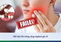 Hối hận khi trồng Implant giá rẻ: 6 rủi ro nguy hiểm cần biết