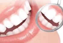 Các loại răng sứ tốt nhất trên thị trường hiện nay – Nha khoa SV phân tích chi tiết