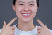 Nên điều trị bệnh nha chu bằng phương pháp gì? Giải thích chi tiết & hướng dẫn điều trị đúng cách tại NHA KHOA SV 