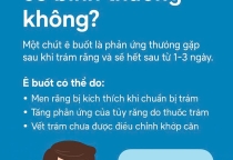 Trám răng xong bị ê buốt có bình thường không? Nguyê n nhân – Cách xử lý – Khi nào cần gặp bác sĩ