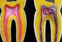 Cách xử lý khi ngà răng bị hư – Tư vấn chuyên môn từ bác sĩ Nha Khoa SV