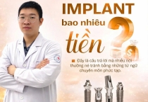 Implant Bao Nhiêu Tiền? Quy Trình Cấy Ghép Implant Tại Nha Khoa SV Chi Tiết Nhất