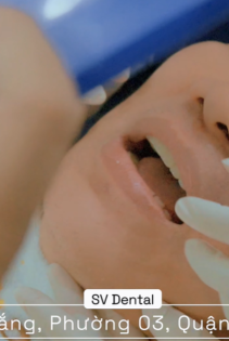 KH Chú hữu đạt làm dịch vụ bắt cầu răng