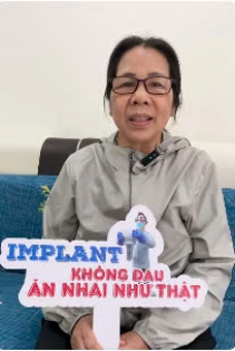 Nghe cô Hoà chia sẽ Làm răng Implant tại Nha khoa SV