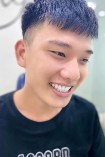 Khách hàng đính đá lên răng 