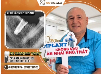 KH ELBAZ BAR YOHAY - CẤY IMPLANT 