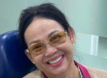 cay-ghep-all-on-6-taitai-nha-khoa-sv-nha-khoa-quan-3-