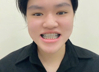 Phương Thảo thực hiện điều trị tại nha khoa sv 