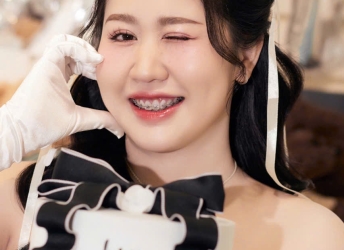 nieng-rang-mac-cai-ky-thuatthuat-cao-tai-nha-khoa-sv-nha-khoa-quan-3-