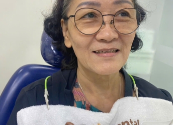 CÔ MAI CẤY GHÉP IMPLANT TẠI NHA KHOA SV 