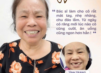 Cô Nghiêm làm răng sứ 