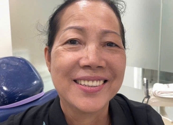 CÔ TRANG THỰC HIỆN GẮN RĂNG SỨ HÀM TRÊN TẠI NHA KHOA SV 