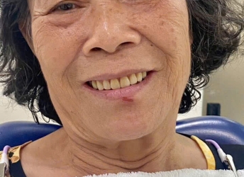 CÔ NGUYỆT ĐIỀU TRỊ HÀM THÁO  LẮP TẠI NHA KHOA SV 