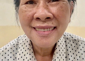 CÔ Ý PHỤC HÌNH  THÁO LẮP TẠI NHA KHOA SV 