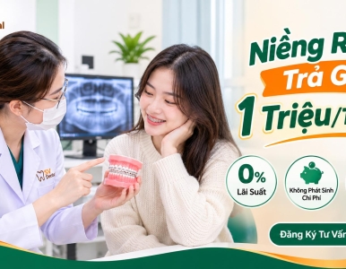 Niềng Răng Trả Góp 1 Triệu/Tháng – Không Lãi Suất, Chủ Động Chi Phí Cùng Nha Khoa SV