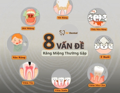 8 Vấn Đề Răng Miệng Thường Gặp — Nguyên Nhân & Cách Phòng Ngừa
