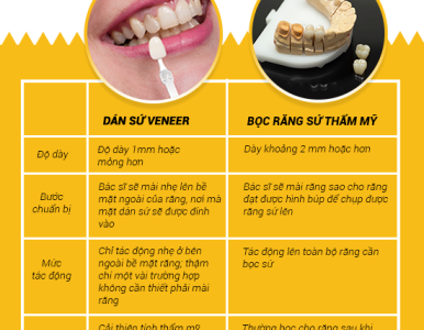 So sánh chi tiết khác biệt giữa bọc răng sứ và dán sứ Veneer