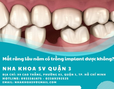 Mất răng lâu năm có trồng implant được không?