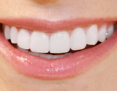 Thẩm mỹ răng sứ là gì? Địa chỉ thẩm mỹ răng sứ uy tín tại quận 3 