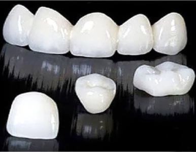 BẢNG GIÁ RĂNG SỨ 