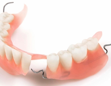 Răng giả tháo lắp TPHCM – Giải pháp phục hồi răng mất an toàn, tiết kiệm