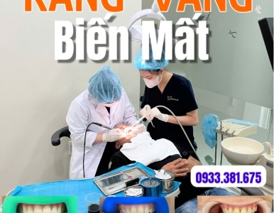 Combo Tẩy Trắng Răng 999K – Răng Vàng Biến Mất Chỉ Sau 1 Lần Làm!
