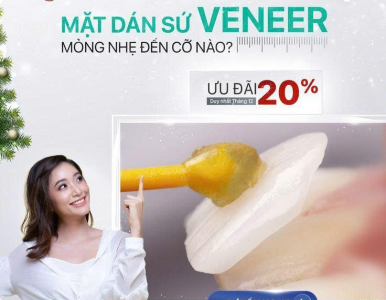 Mặt Dán Sứ Veneer Mỏng Nhẹ Đến Cỡ Nào? Giải Pháp Thẩm Mỹ Ít Mài Răng Tại Nha Khoa SV