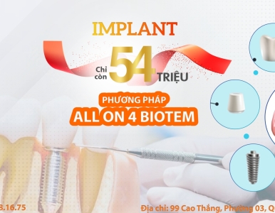 Giải Pháp Trồng Răng Toàn Hàm Với Implant All On 4 BIOTEM – Chỉ Còn 54 Triệu Tại SV Dental