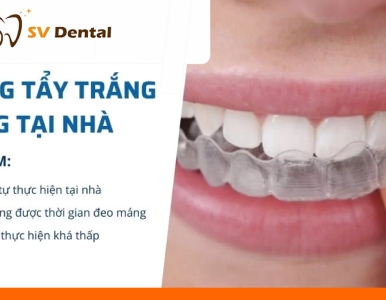 Tẩy Trắng Răng Với Máng Tẩy Tại Nhà – Giải Pháp Cho Nụ Cười Trắng Sáng