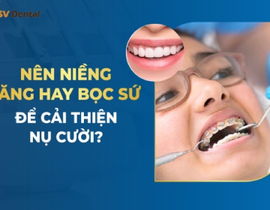 Nên Niềng Răng Hay Bọc Sứ Để Cải Thiện Nụ Cười? – Chuyên Gia SV Dental Giải Đáp